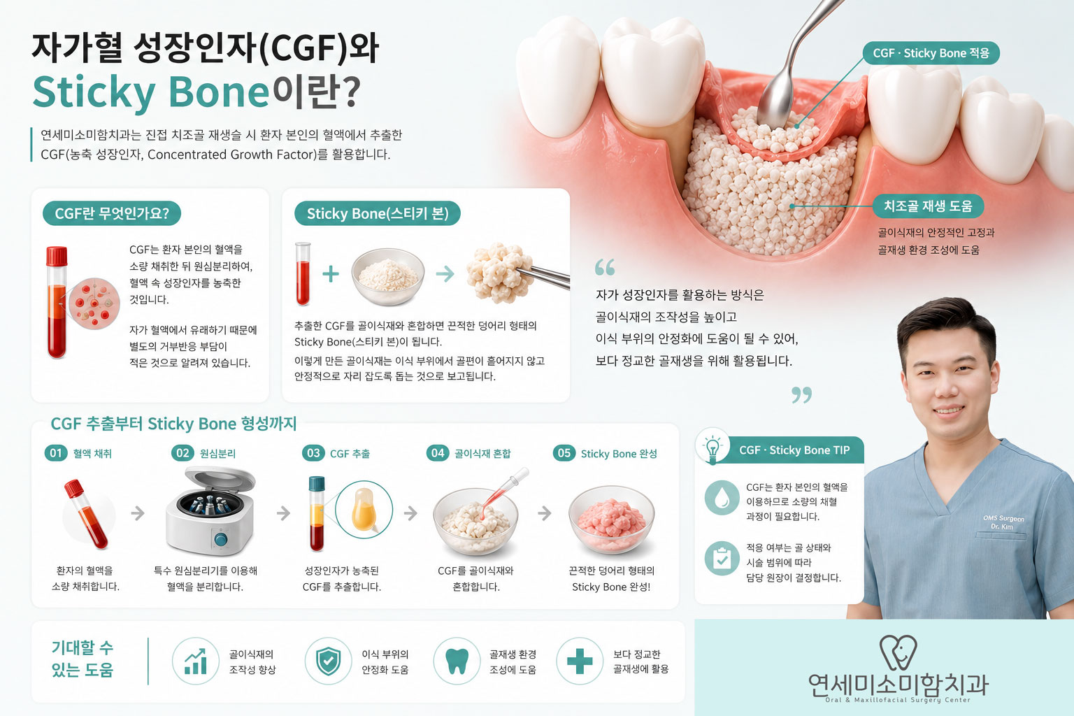 진접 임플란트 뼈이식 CGF Sticky Bone — 연세미소미함치과 자가혈 성장인자 골이식 과정