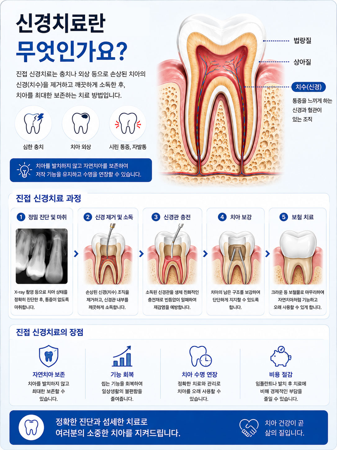 진접 신경치료 연세미소미함치과 — 근관치료 감염된 치수 제거 과정