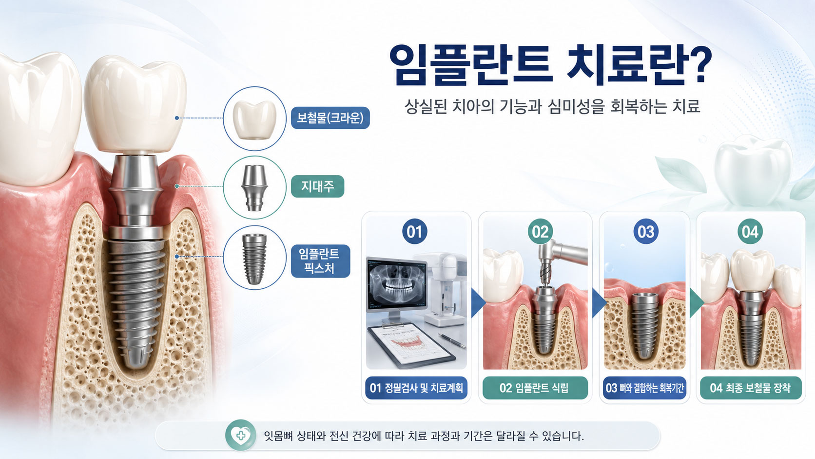 오남 임플란트 연세미소미함치과 — 3D CT 정밀 진단 임플란트 식립